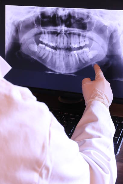 Best Emergency Dentist for Lost Fillings or Crowns in Gambrills, MD