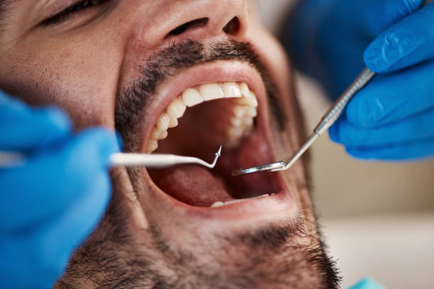 Best Mobile Emergency Dentist in Gambrills, MD