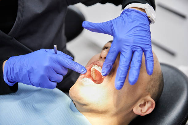 Best Emergency Dental Care for Abscessed Tooth in Gambrills, MD