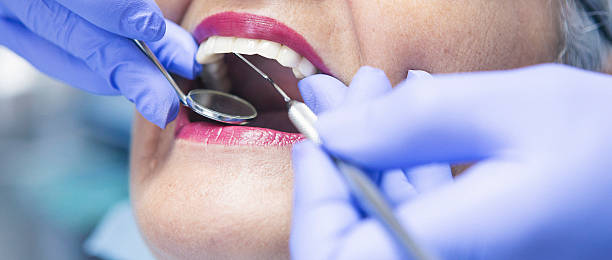 Best Emergency Dentist for Knocked-Out Tooth in Gambrills, MD